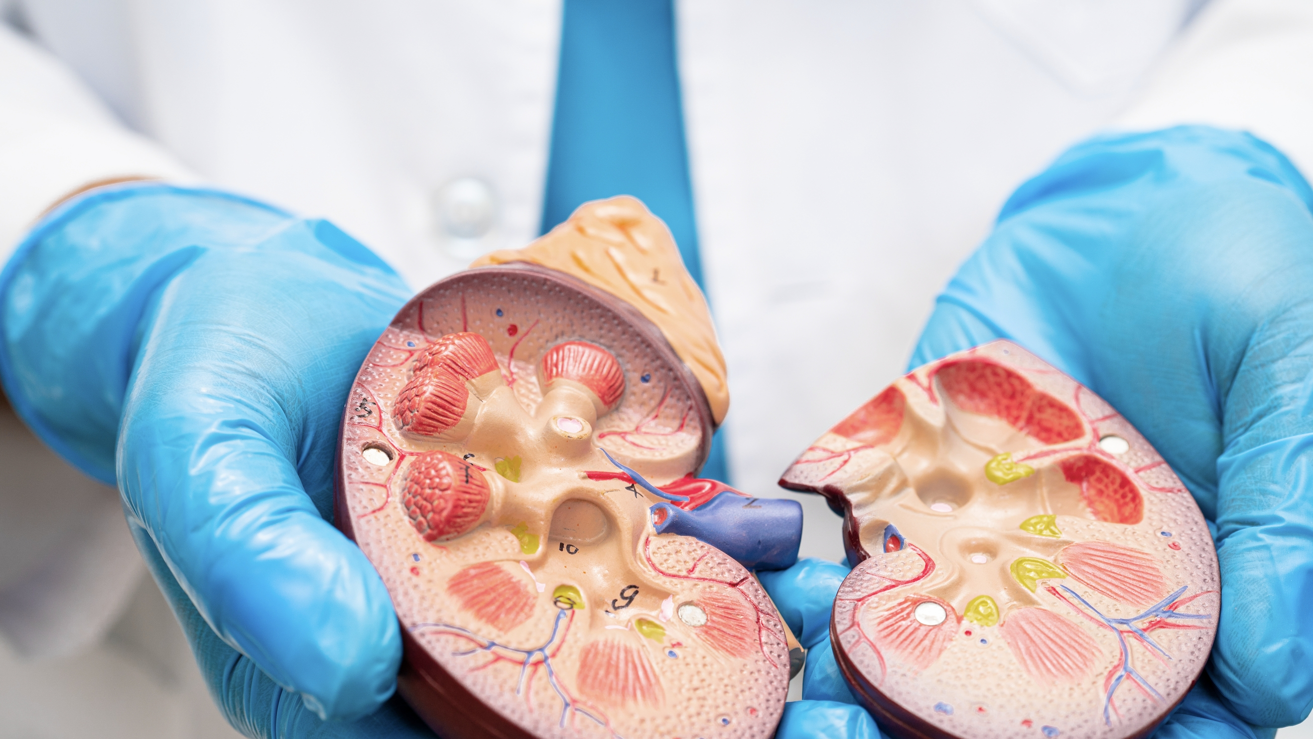 신장 생검 (Kidney Biopsy)