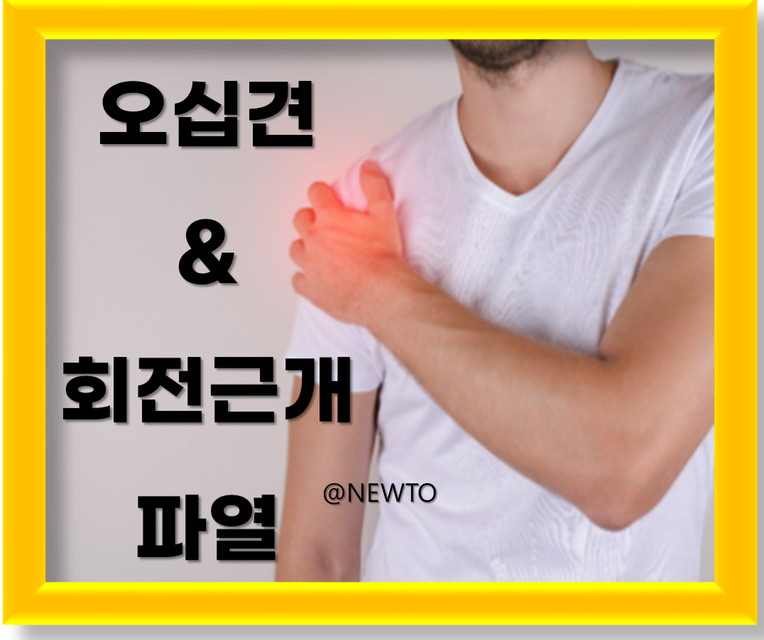 오십견&회전근개파열의 원인 및 증상, 예방법