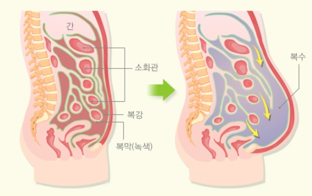 복수천자주의사항