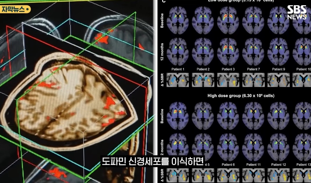 신경외과-장진우-교수