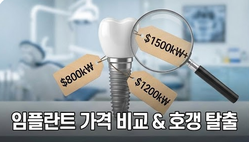 임플란트 가격 비교