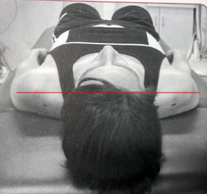 라운드숄더에서-가슴근육-길이-측정