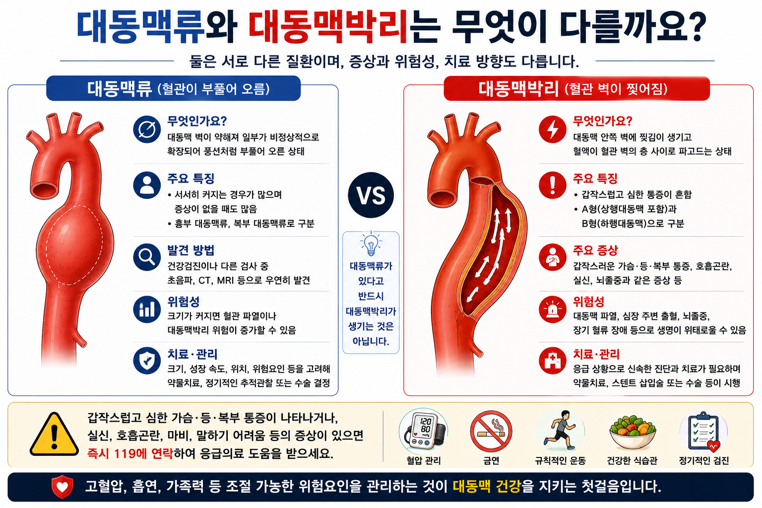 대동맥류의 확장과 대동맥박리의 벽층 분리를 비교한 개념 그림