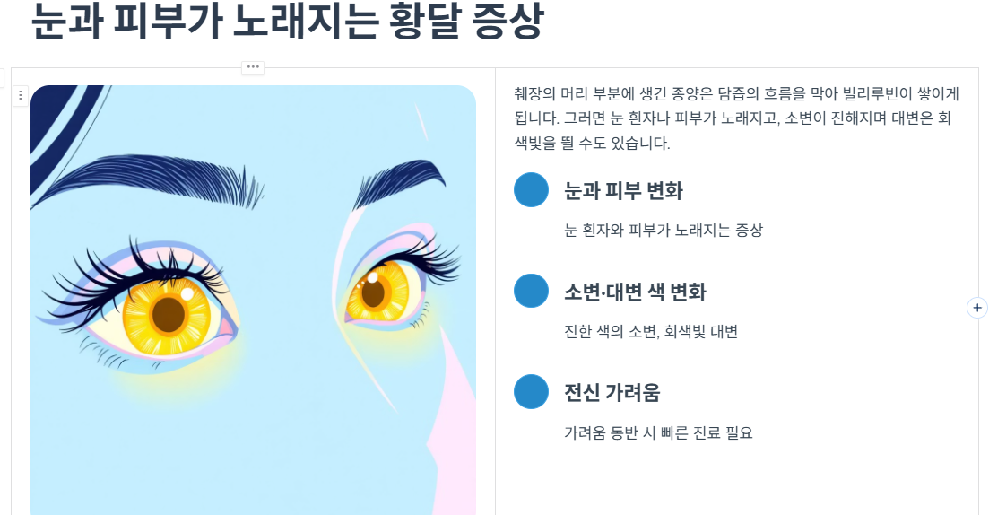 눈과 피부가 노래지는 황달 증상