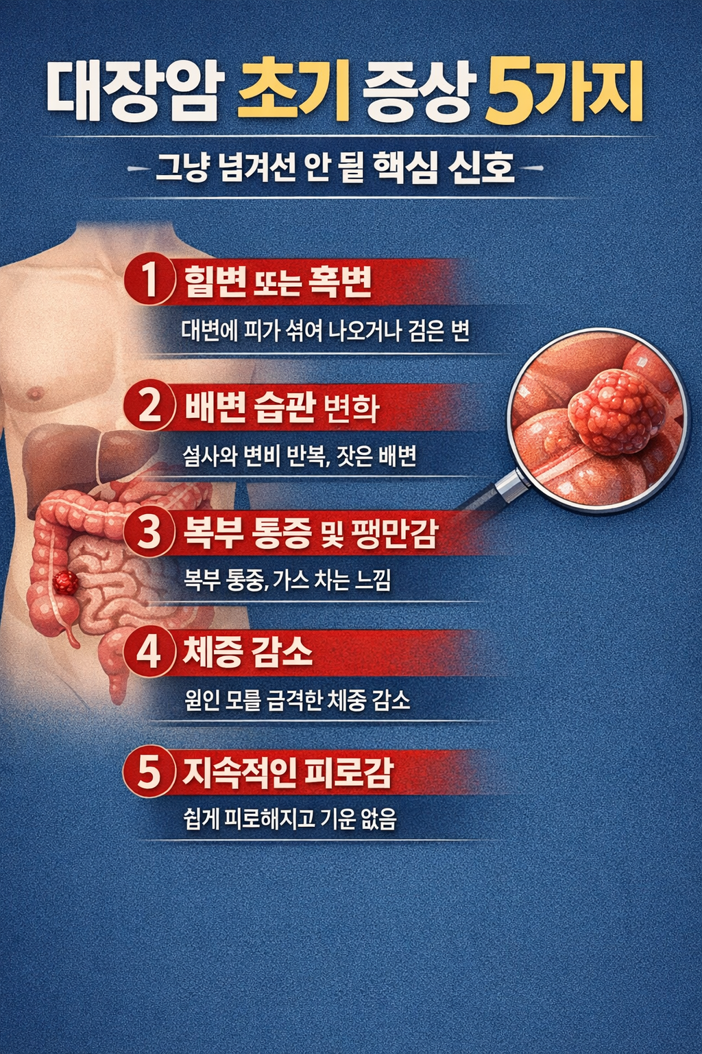 대장암 초기 증상 5가지, 그냥 넘겨선 안 될 핵심 신호