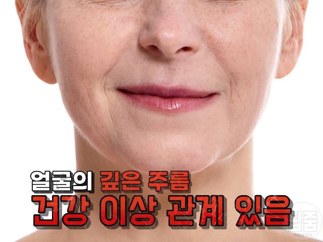 얼굴주름 골다공증 팔자주름 귓볼주름 심장마비