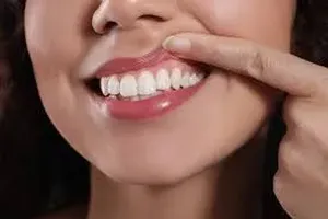 치아