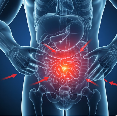 맹장염 초기증상