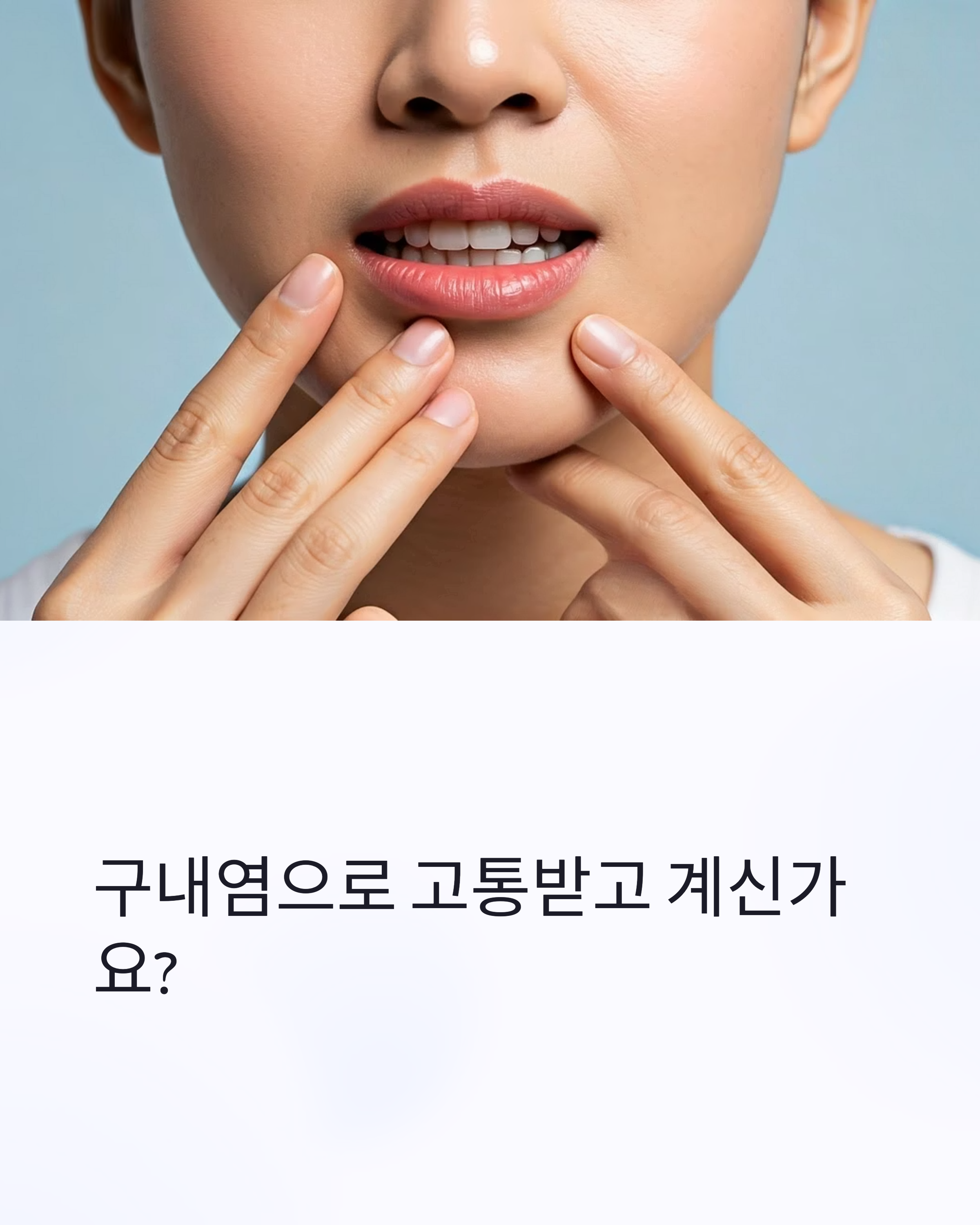 암치료 중 구내염 관리