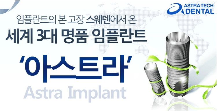 임플란트 종류