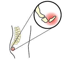 꼬리뼈가 아픈 이유