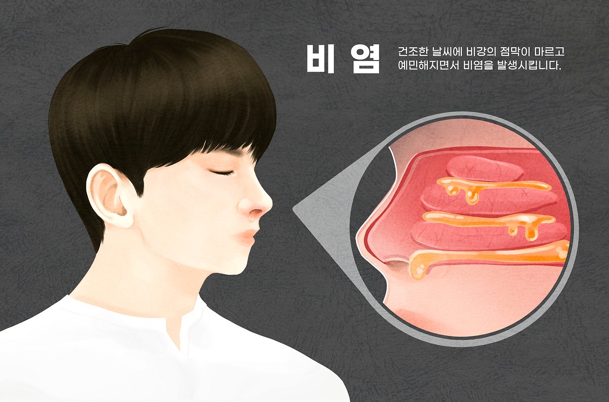 비염이란 설명