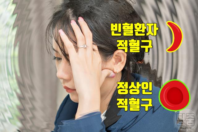 추위 잘 타는 사람 특징 질환 빈혈