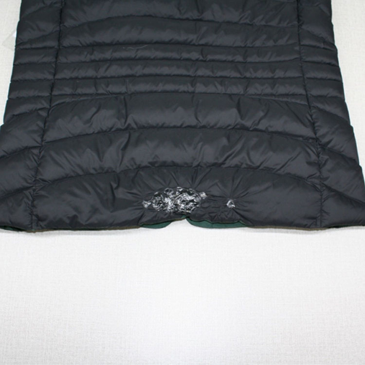 등 하단 불에 그을린 사진