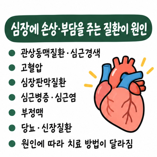 관상동맥질환·심근경색, 고혈압, 판막질환, 심근병증·심근염, 부정맥, 당뇨·신장질환 등 심부전의 주요 원인을 정리한 카드