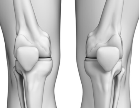 50λ κ΄μ ν΅μ¦, μμΈκ³Ό λμ²λ²