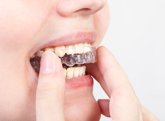 마우스피스를 사용하는 여성