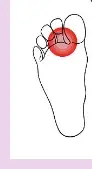 손발 저림 원인