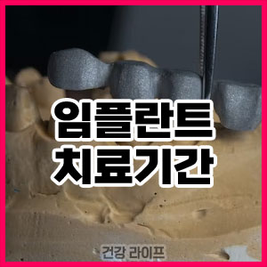 임플란트 치료기간