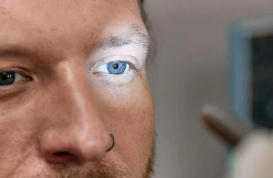 안구건조증 증상 원인