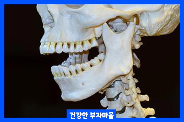 턱관절 통증 원인에 따라 항생제, 근육 이완제, 스테로이드 주사로 치료