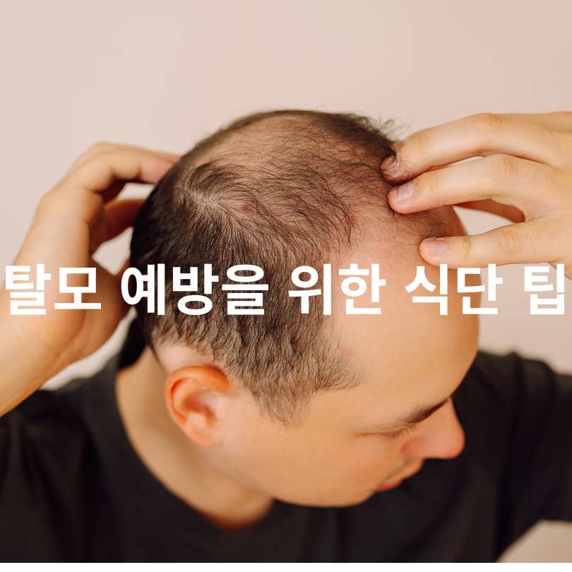 탈모에 좋은 음식 총정리!