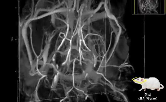 인벤테라 조영제를 이용해 랫드의 뇌(크기 약 2 cm)를 촬영한 영상