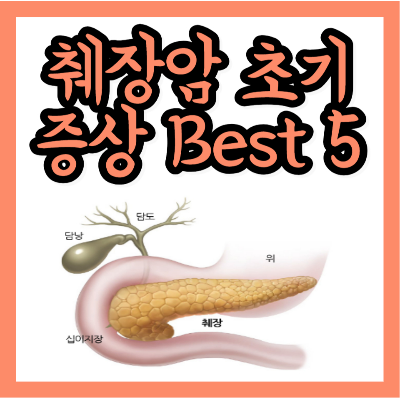 췌장암 초기증상 Best 5, 이것만 기억하세요!