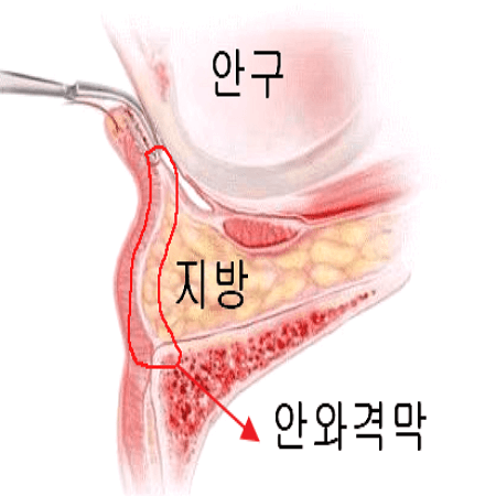 지방을 감싸고 있는 안와격막의 위치