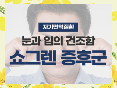 쇼그렌증후군 증상과 치료방법