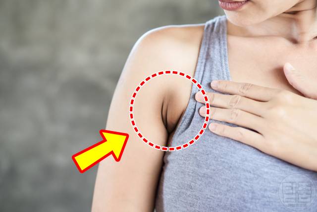 피부병 증상 유방암 당뇨병 갑상선 엽산결핍 혀암 글루텐과민증