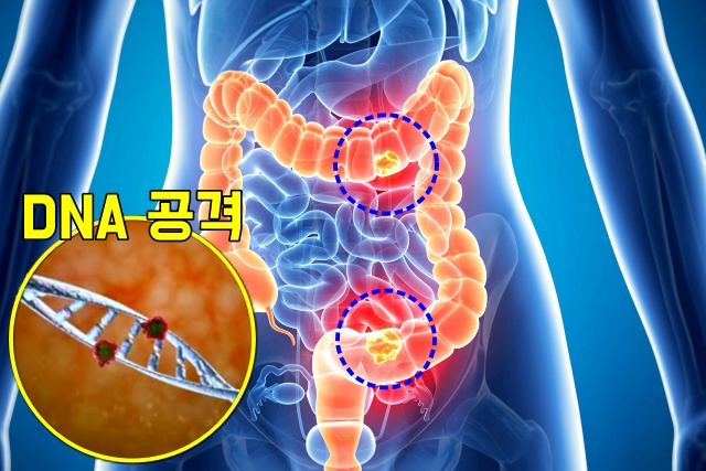 활성산소 대장암 위암 간암 췌장암, 항산화제, 건강 팁줌 매일꿀정보