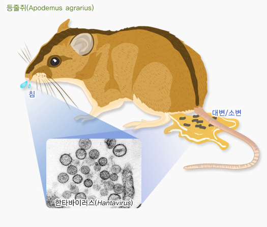 신증후군 출혈열, 한탄바이러스의 원인은 집쥐나 들쥐다! 그 이유는?