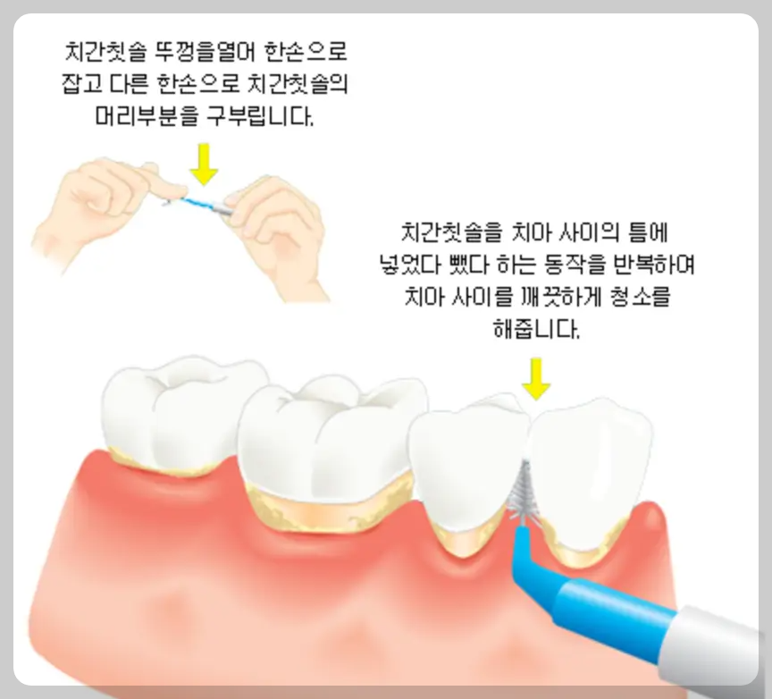 치간칫솔 사용법