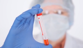 비타민 D 혈액 검사