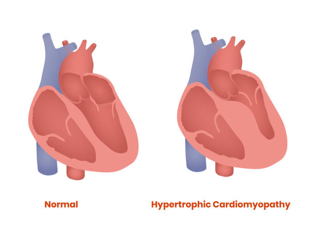 과탄산혈증(hypercapnia) 증상