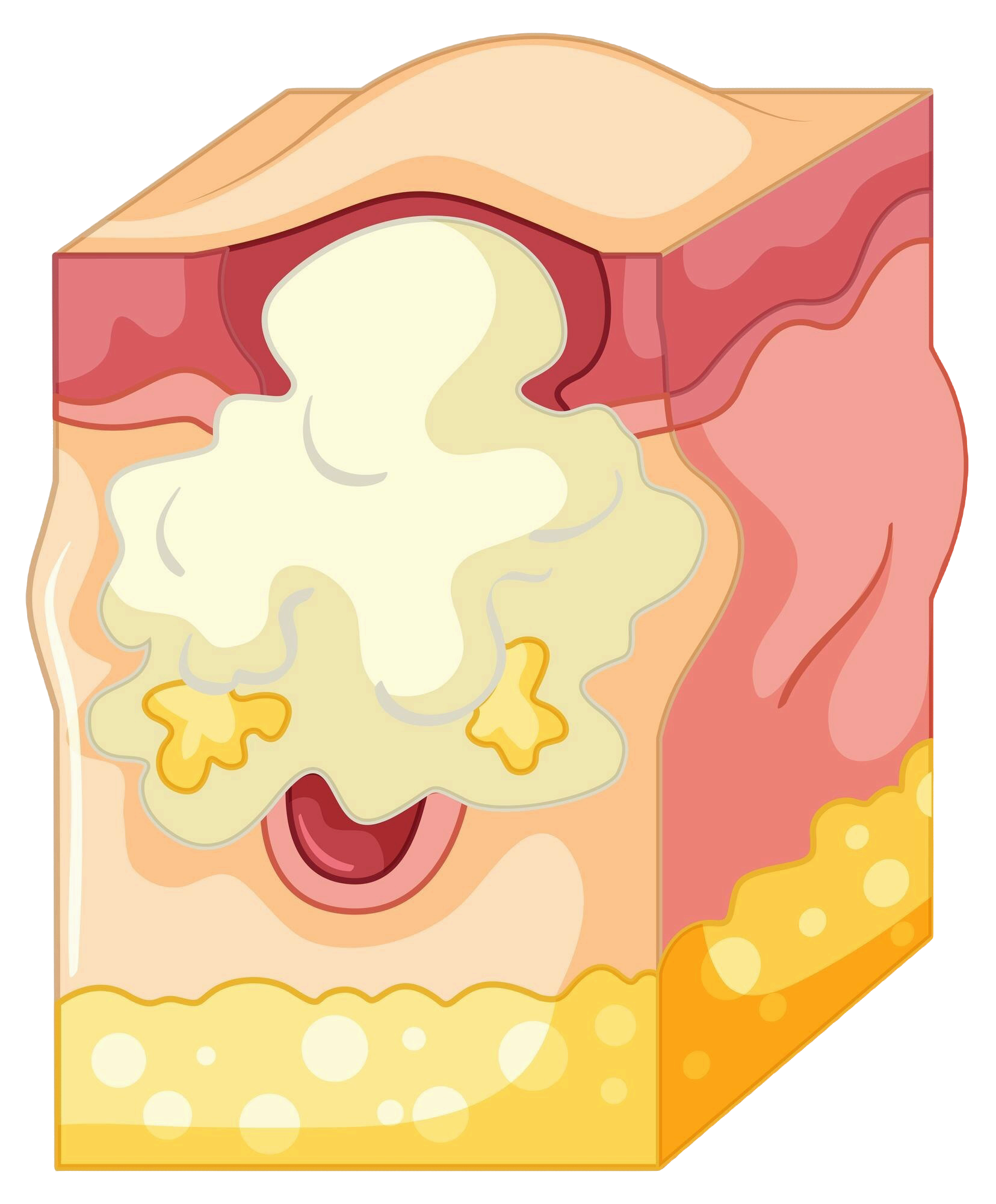 지루성 피부염 vs 일반 비듬 : 비슷해 보이지만 다른 문제