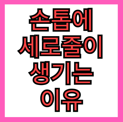 손톱에 세로줄이 생기는 이유