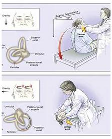 덱스 홀파크 검사