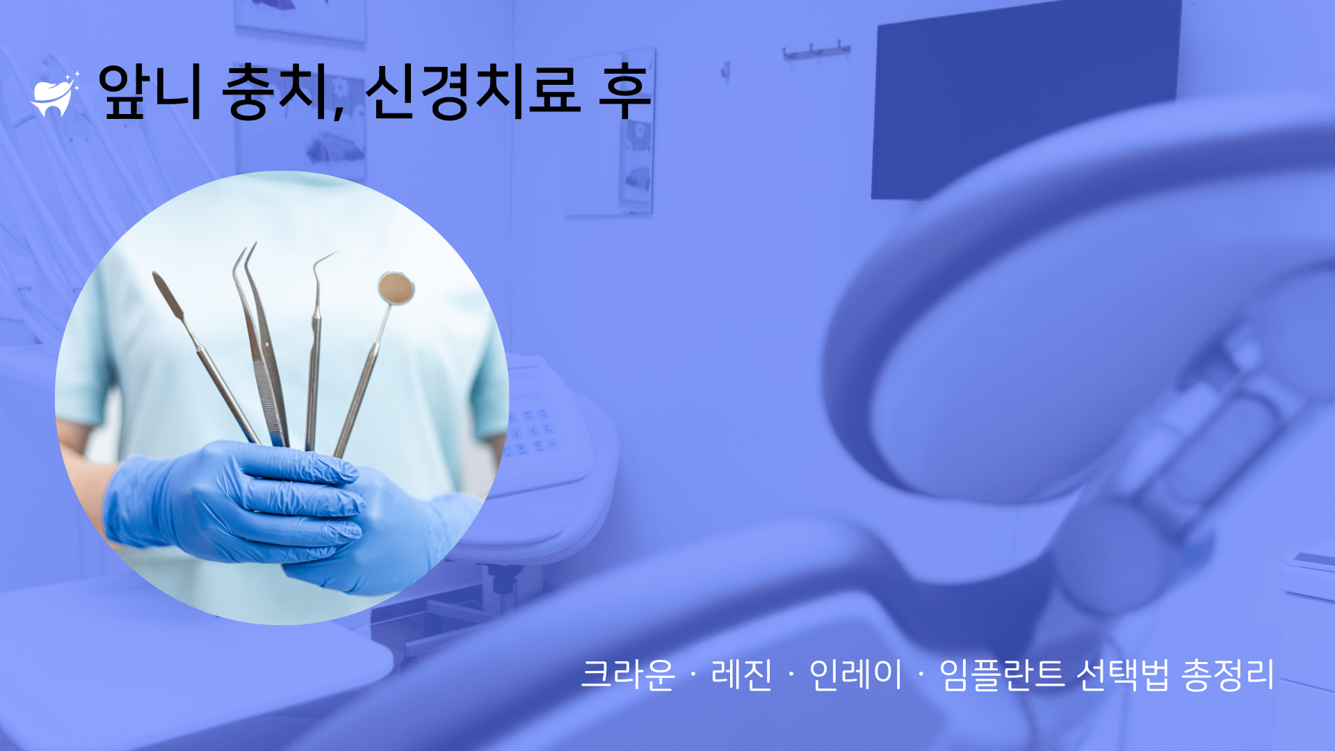 앞니 충치 치료후 크라운, 레진, 인레이, 임플란트 선택법 총정리