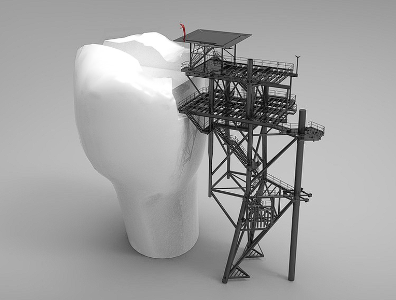 치아보험 면책기간