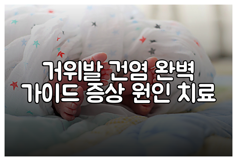 거위발 건염 완벽 가이드 증상 원인 치료