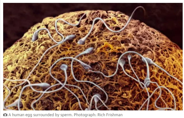 정자를 난자로 끌어당기는 단백질 발견...난임부부에 희소식 Protein discovery on human eggs may shed light on unexplained infertility