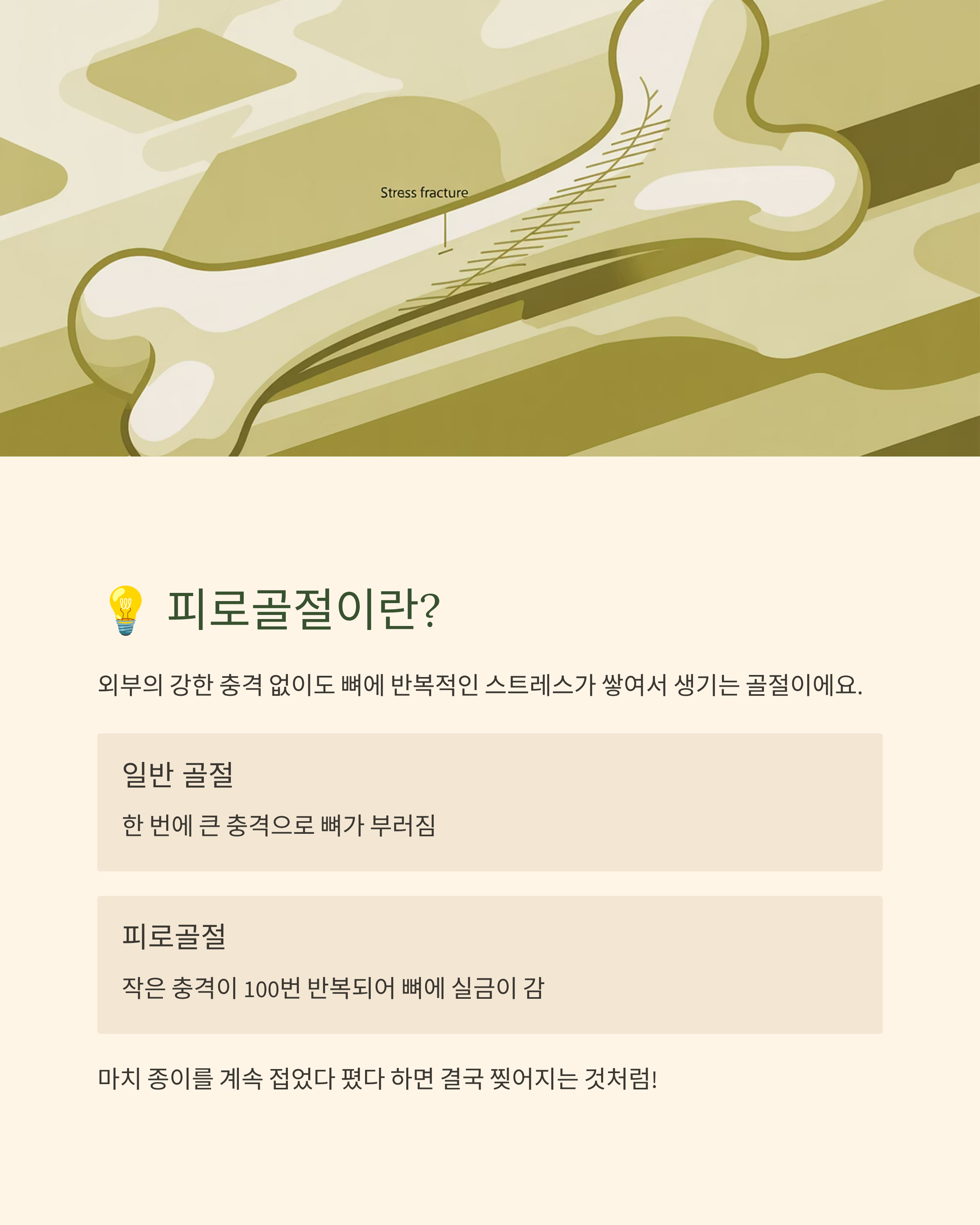 피로골절관련사진