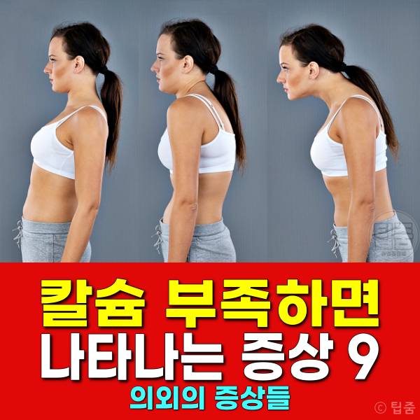 칼슘이 부족하면 나타나는 증상,골다공증