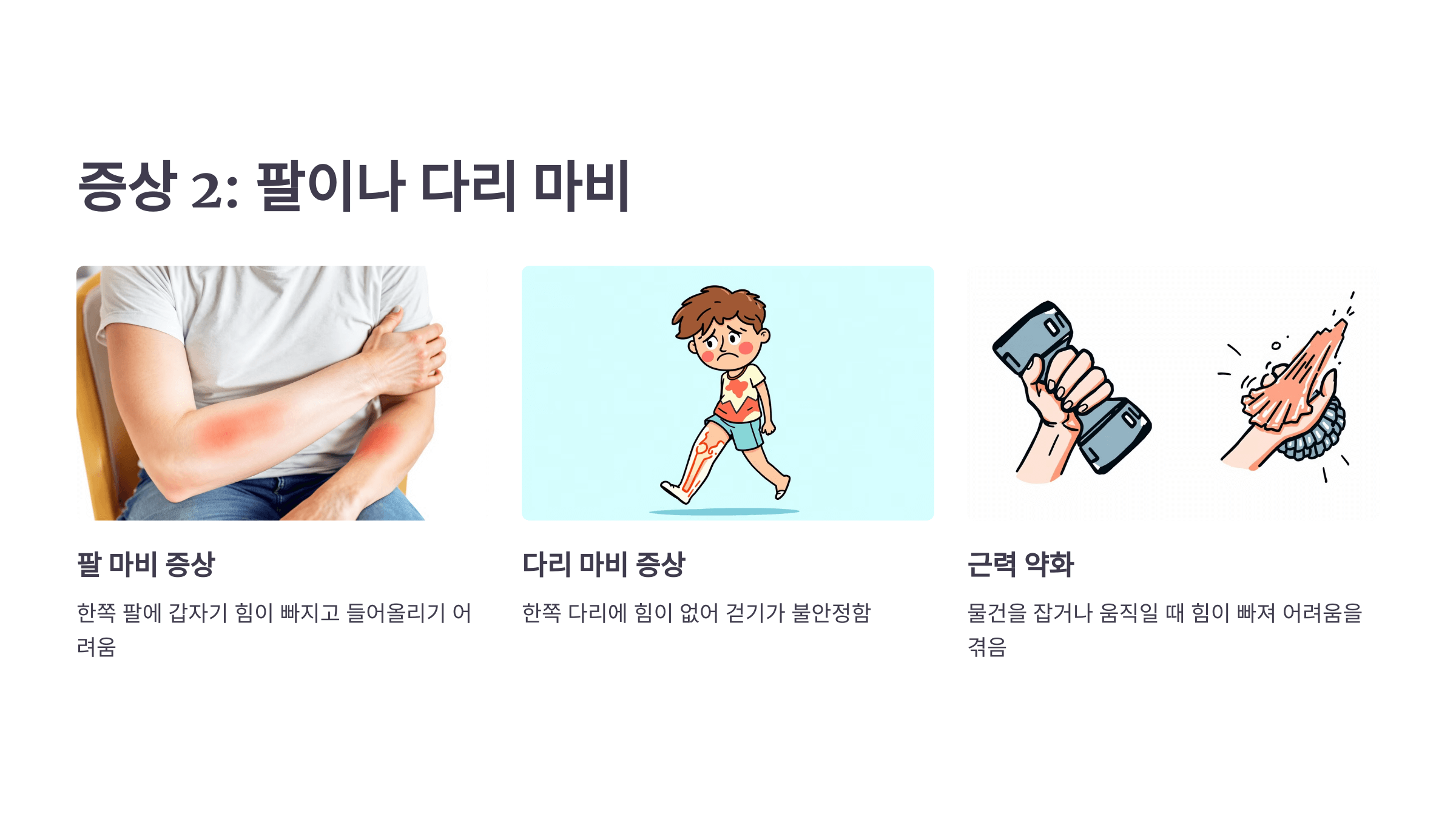 뇌경색과 관련된 사진입니다.