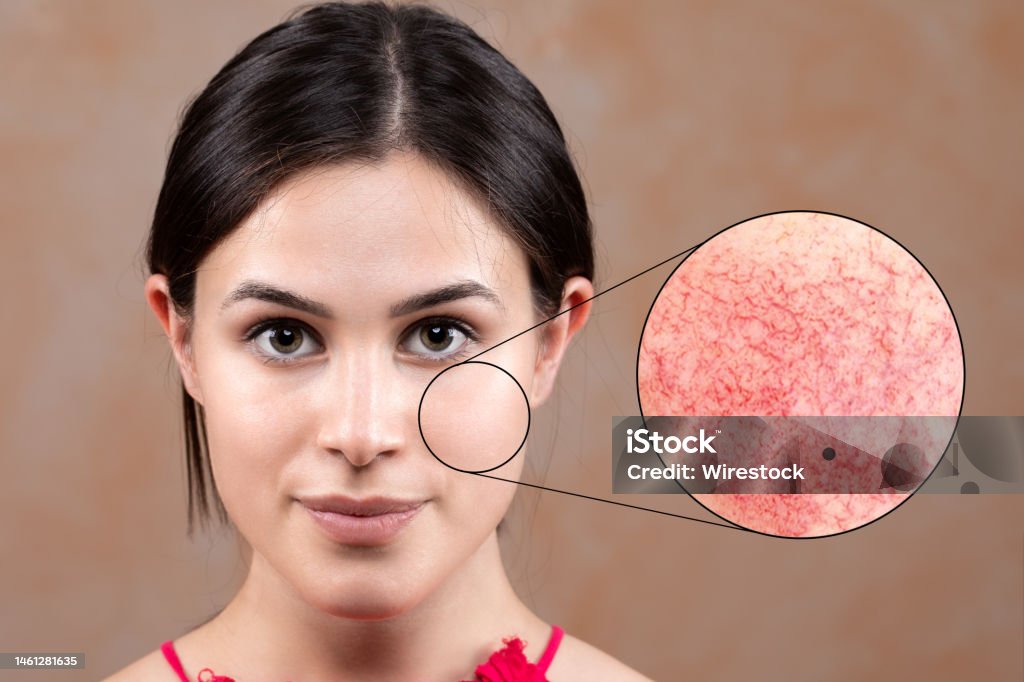 갱년기 홍조 증상의 원인과 해결법 정리