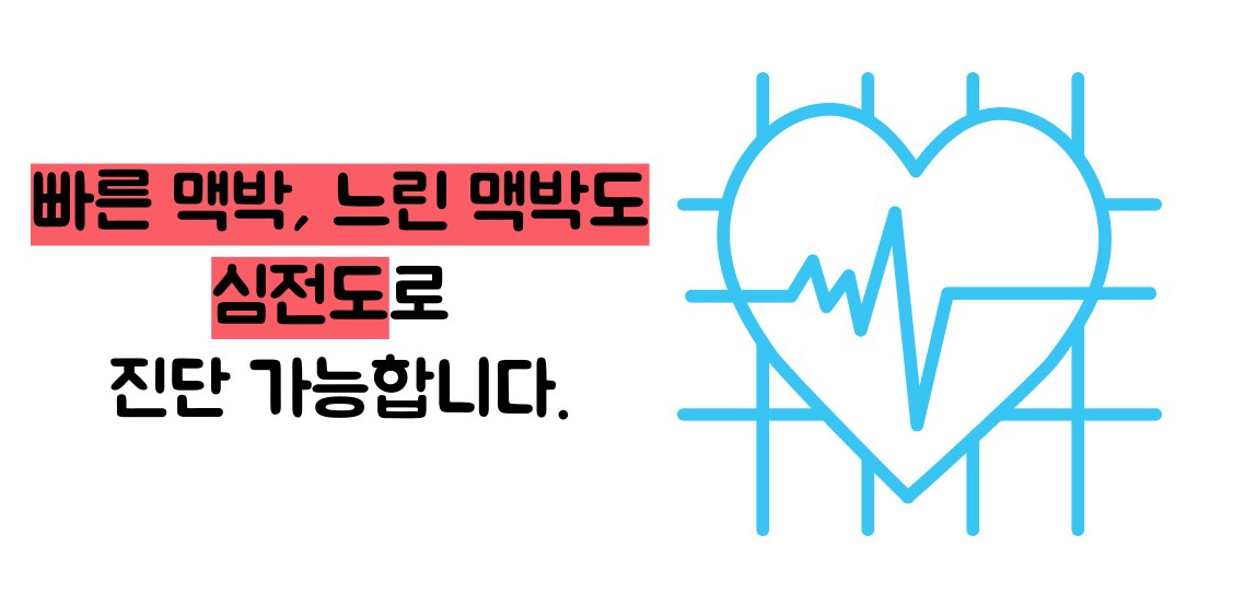 심전도 검사