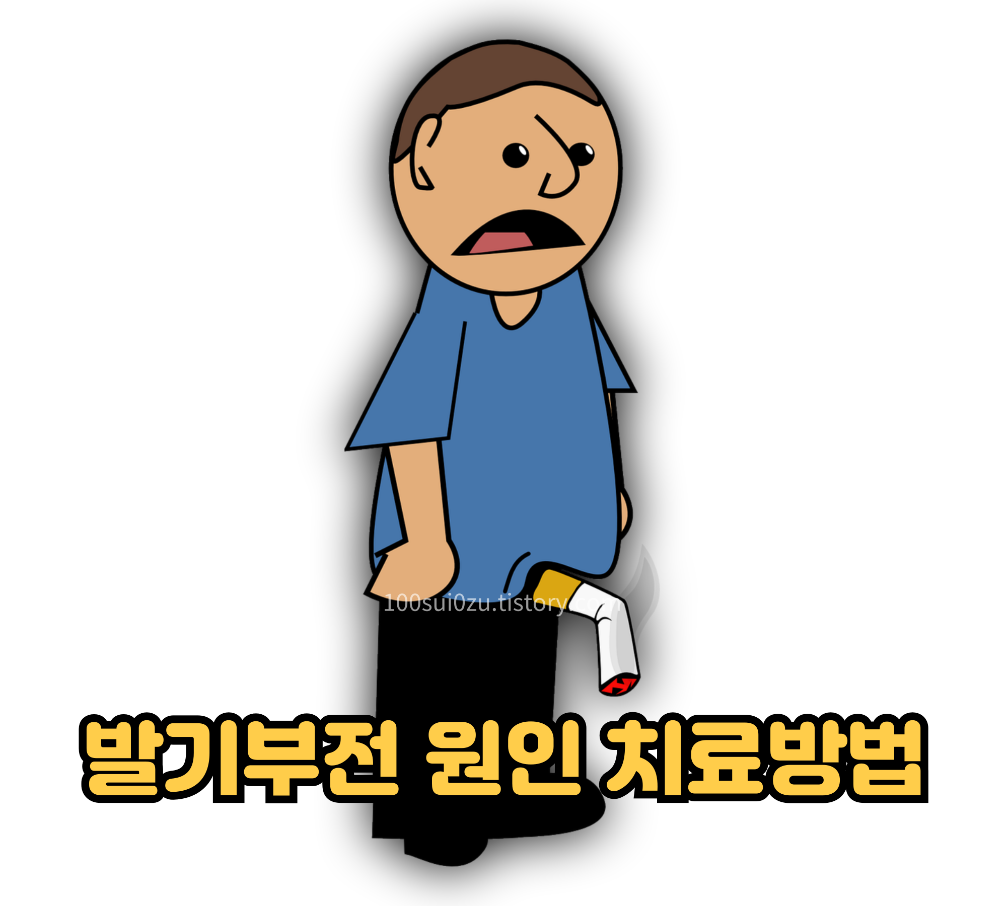 발기부전-원인-치료방법.jpg