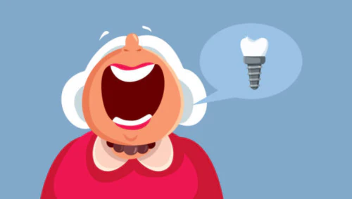 차상위 임플란트 지원 8